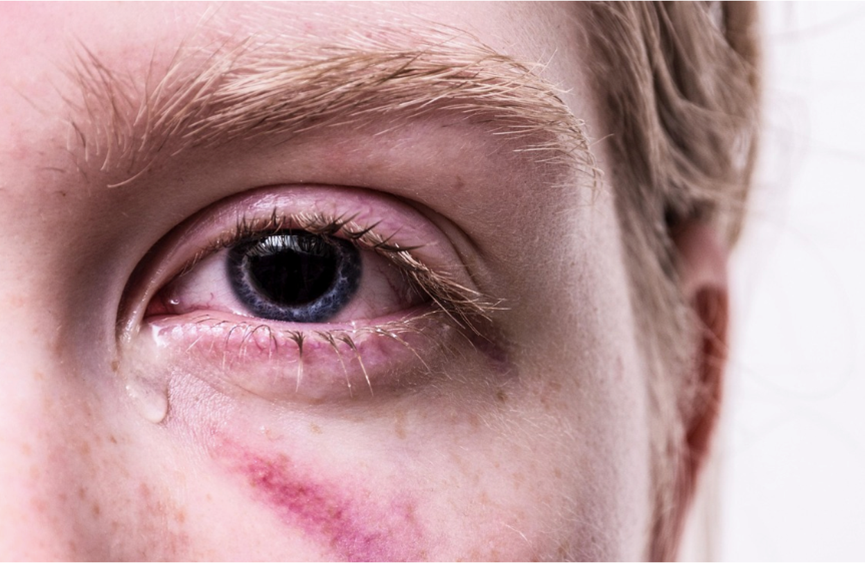 A troubled teenager crying, while considering self-harm
