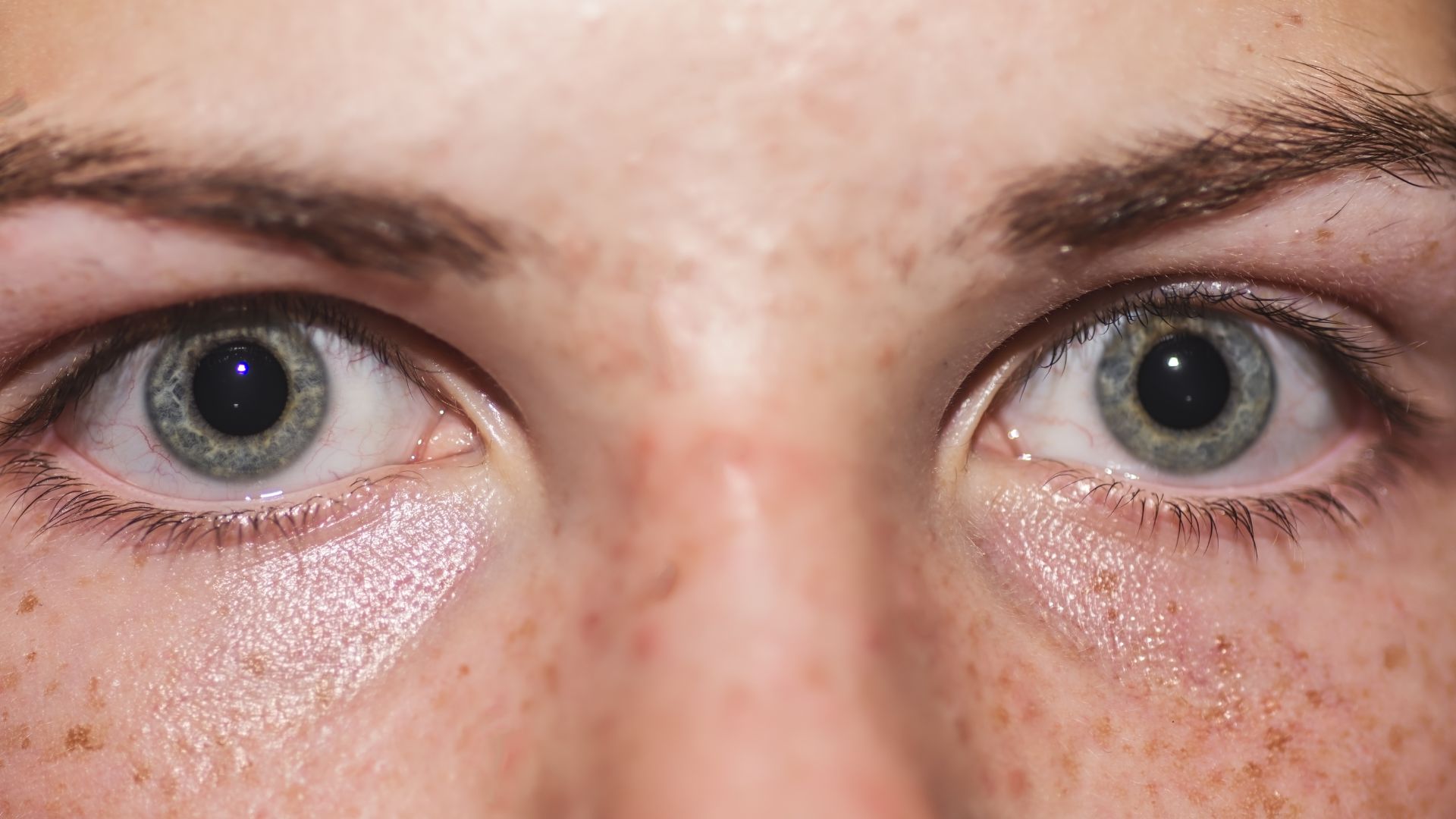 Does-DXM-Make-Your-Pupils-Big